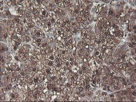 ACY1 Antibody in Immunohistochemistry (Paraffin) (IHC (P))