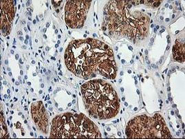 ACY1 Antibody in Immunohistochemistry (Paraffin) (IHC (P))