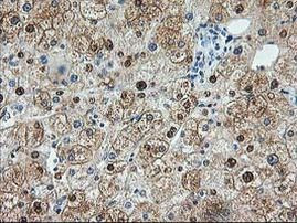 ACY1 Antibody in Immunohistochemistry (Paraffin) (IHC (P))