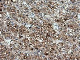 ACY1 Antibody in Immunohistochemistry (Paraffin) (IHC (P))