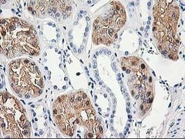 ACY1 Antibody in Immunohistochemistry (Paraffin) (IHC (P))