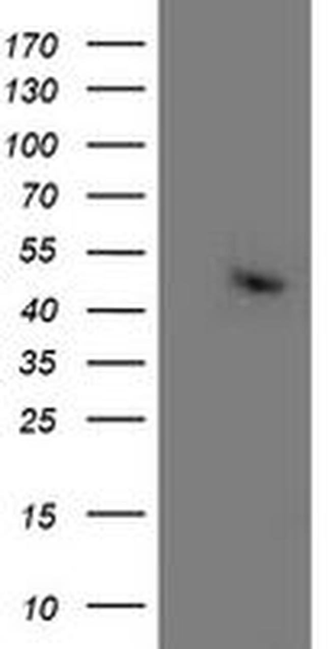 ACY1 Antibody in Western Blot (WB)