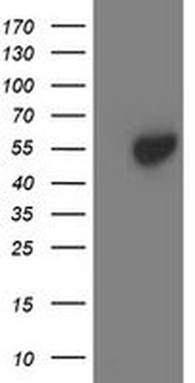 ACY1 Antibody in Western Blot (WB)