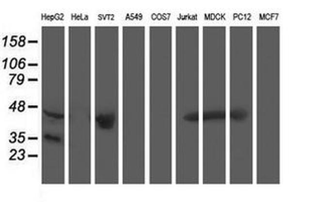 ACY1 Antibody in Western Blot (WB)