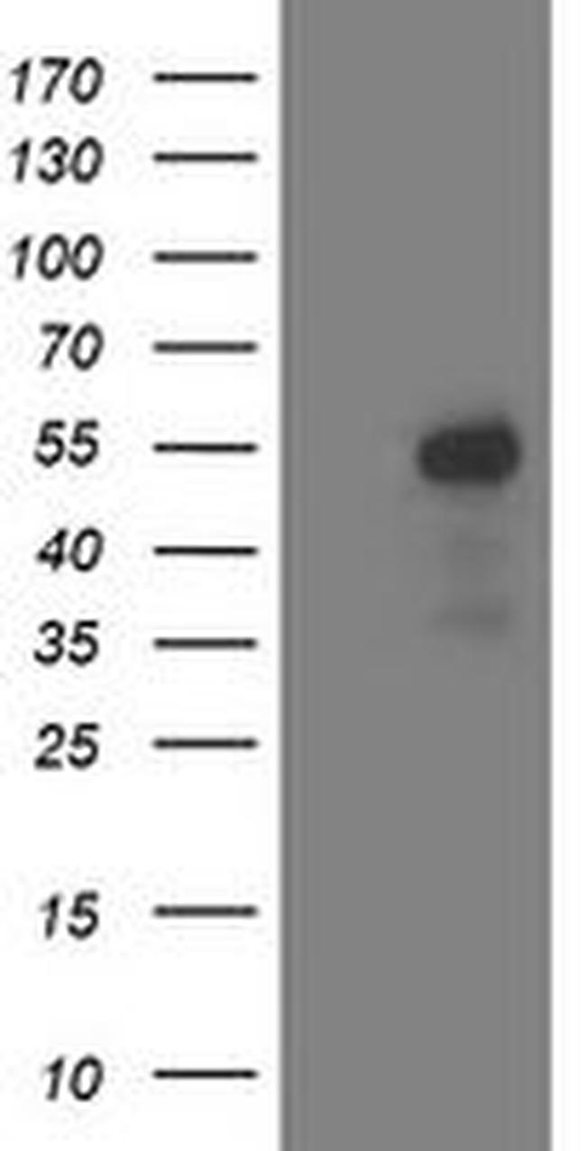 ACY1 Antibody in Western Blot (WB)