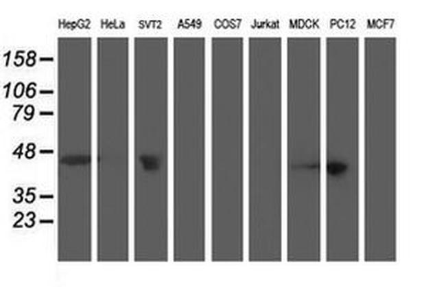 ACY1 Antibody in Western Blot (WB)