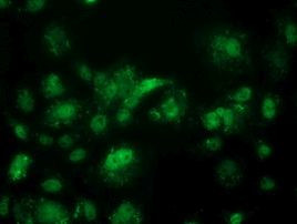 ACY3 Antibody in Immunocytochemistry (ICC/IF)