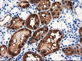 ACY3 Antibody in Immunohistochemistry (Paraffin) (IHC (P))