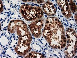 ACY3 Antibody in Immunohistochemistry (Paraffin) (IHC (P))