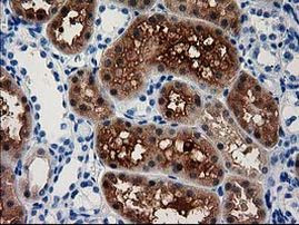 ACY3 Antibody in Immunohistochemistry (Paraffin) (IHC (P))