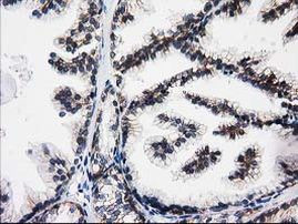 ACY3 Antibody in Immunohistochemistry (Paraffin) (IHC (P))