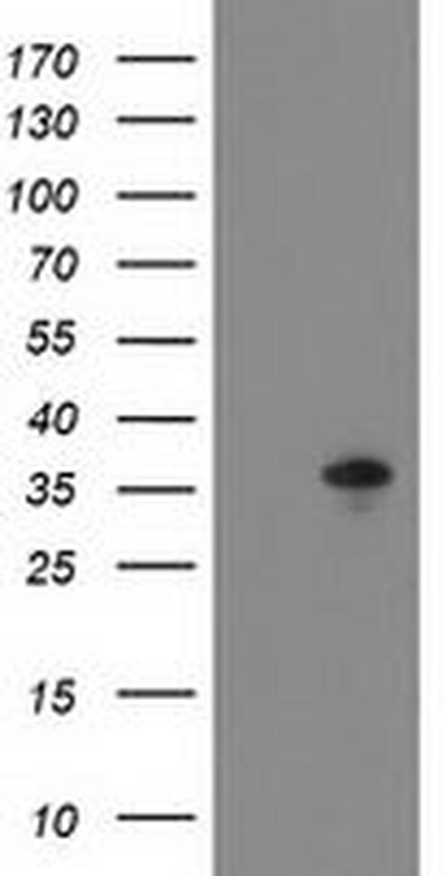 ACY3 Antibody in Western Blot (WB)