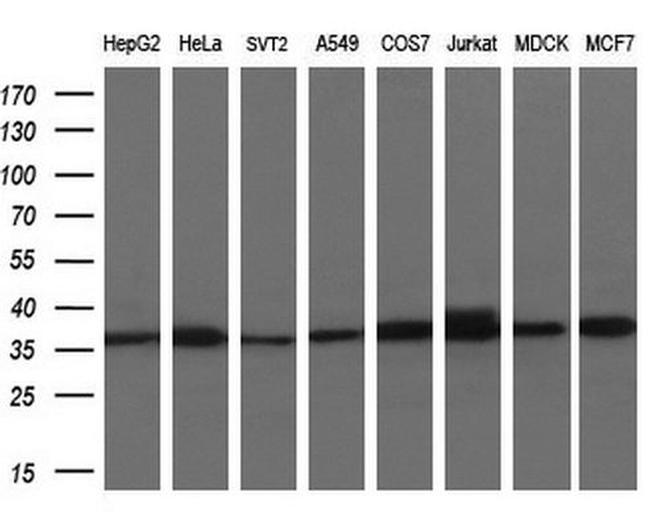 ACY3 Antibody in Western Blot (WB)