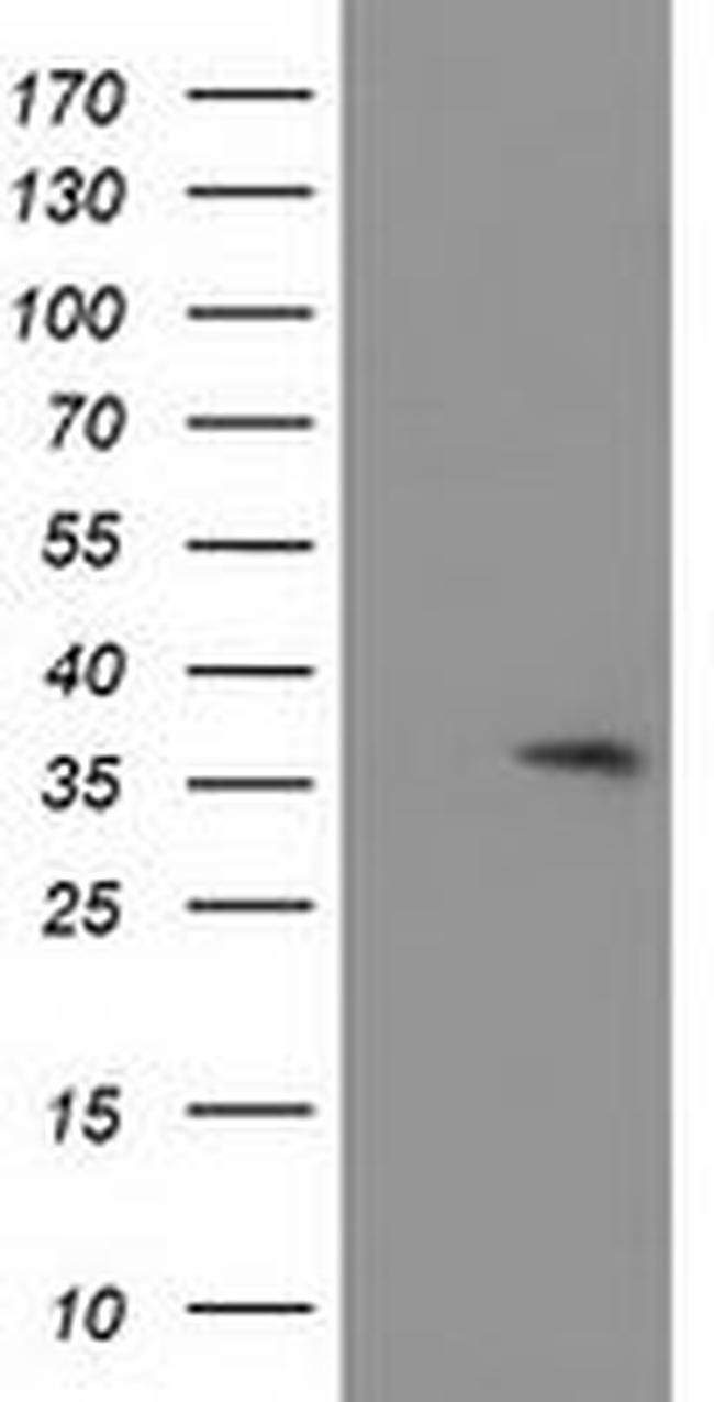 ACY3 Antibody in Western Blot (WB)