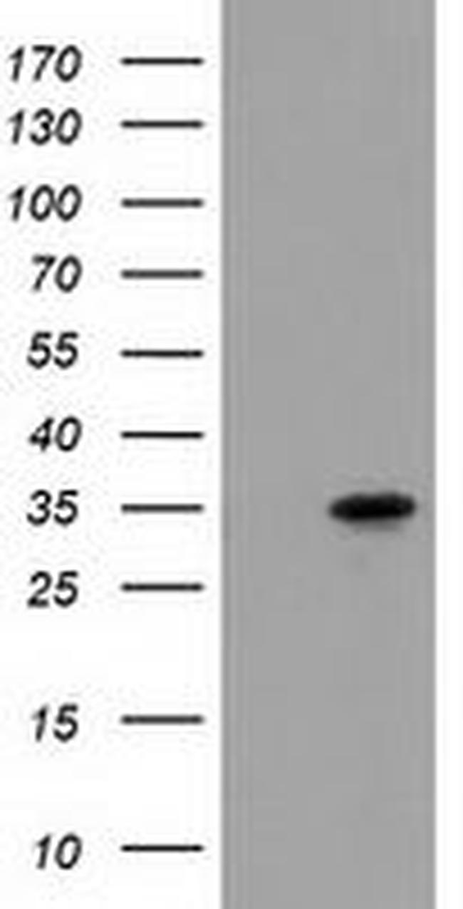 ACY3 Antibody in Western Blot (WB)