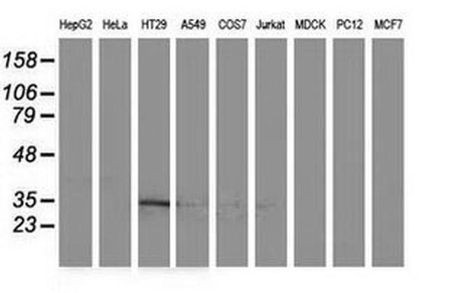 ACY3 Antibody in Western Blot (WB)