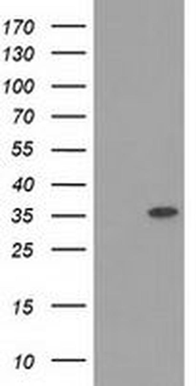 ACY3 Antibody in Western Blot (WB)