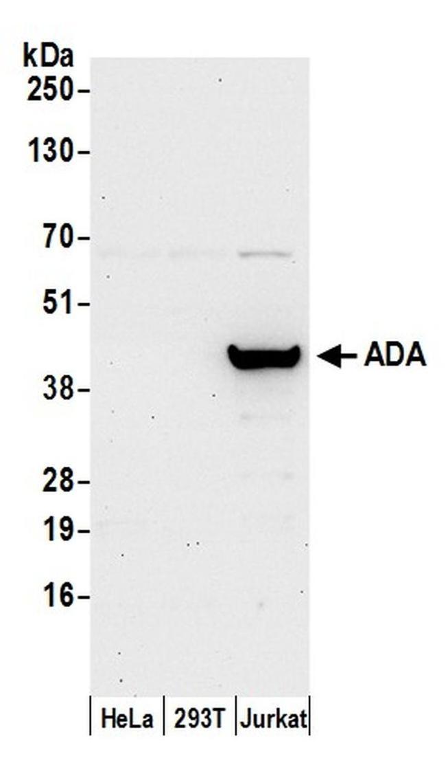 ADA/Adenosine Deaminase Antibody in Western Blot (WB)