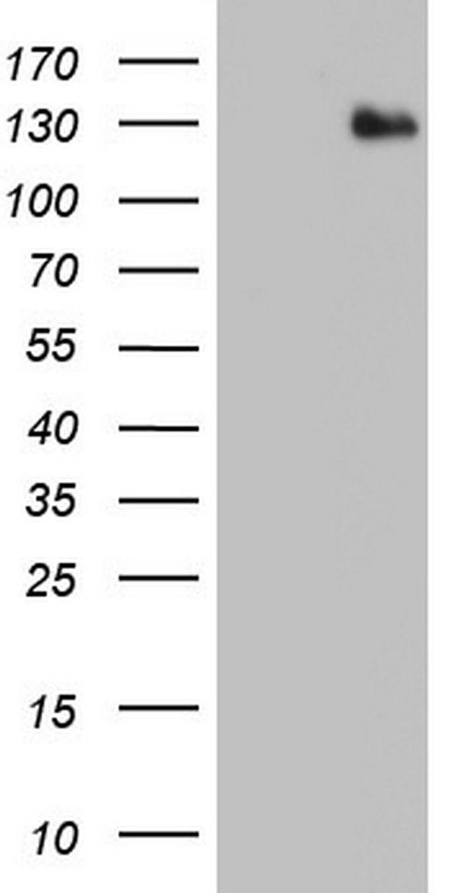 ADAMTS1 Antibody in Western Blot (WB)