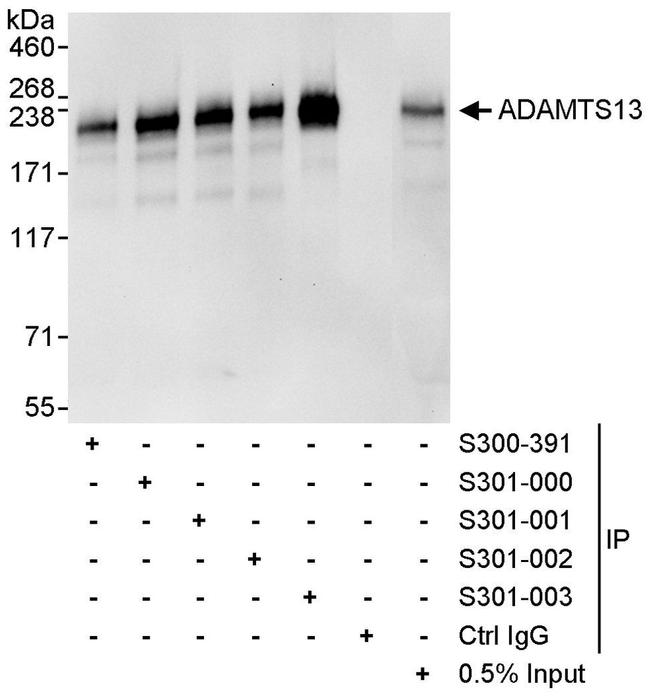 ADAMTS13 Antibody in Western Blot (WB)