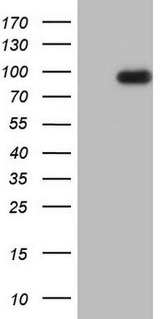 ADAMTS4 Antibody in Western Blot (WB)