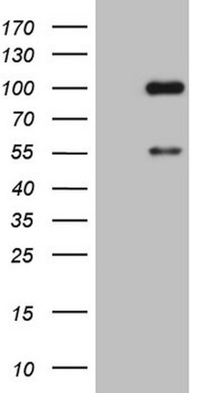 ADAMTS4 Antibody in Western Blot (WB)