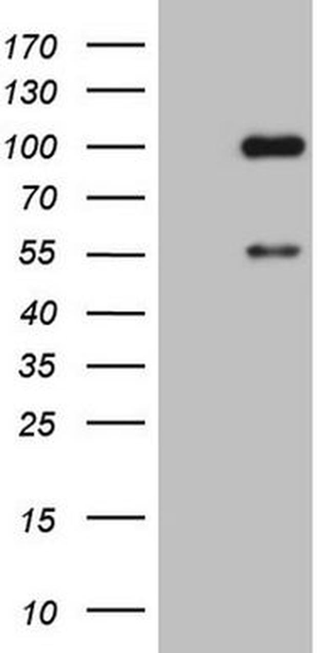 ADAMTS4 Antibody in Western Blot (WB)