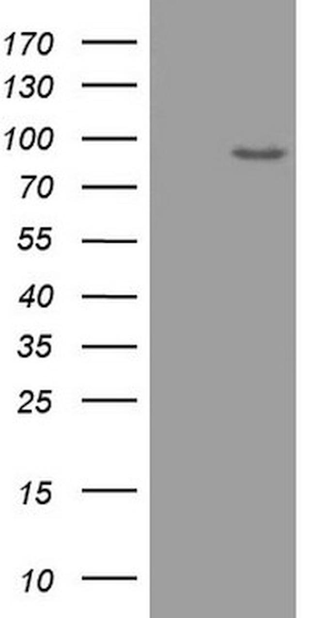 ADAMTS4 Antibody in Western Blot (WB)