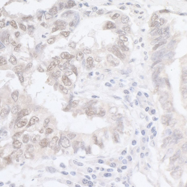 ADAR1 Antibody in Immunohistochemistry (IHC)