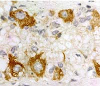 PACAP Receptor Antibody in Immunohistochemistry (IHC)