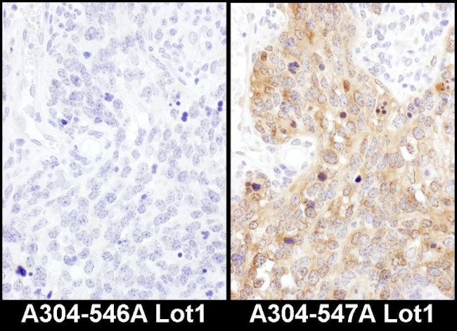 ADE2 Antibody in Immunohistochemistry (IHC)