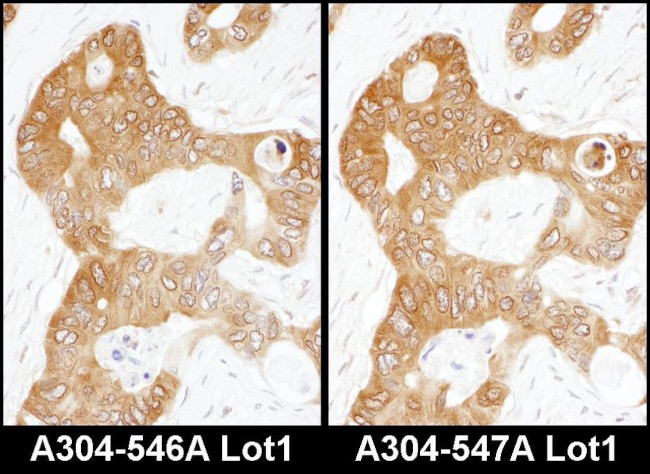 ADE2 Antibody in Immunohistochemistry (IHC)