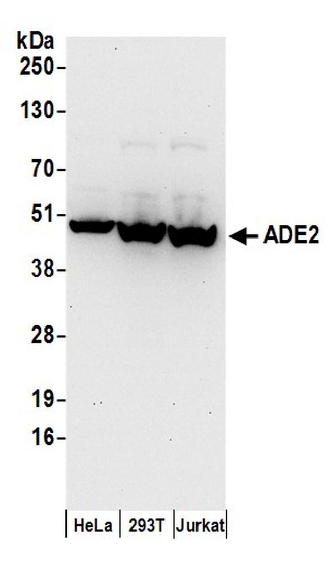 ADE2 Antibody in Western Blot (WB)