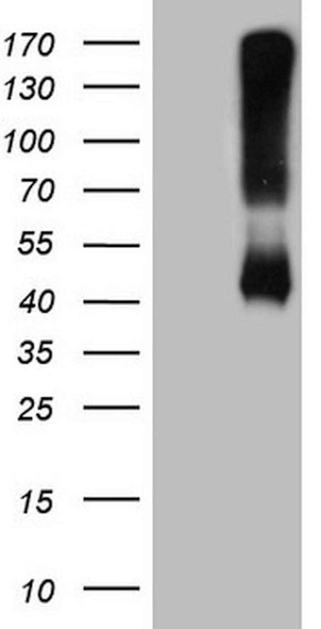 ADH5 Antibody in Western Blot (WB)