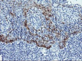 ADH7 Antibody in Immunohistochemistry (Paraffin) (IHC (P))