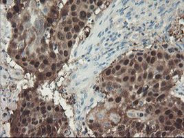 ADH7 Antibody in Immunohistochemistry (Paraffin) (IHC (P))