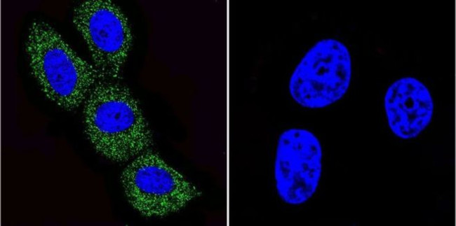 ARF1/ARF3/ARF5/ARF6 Antibody in Immunocytochemistry (ICC/IF)