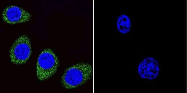 ARF1/ARF3/ARF5/ARF6 Antibody in Immunocytochemistry (ICC/IF)