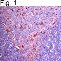 alpha-2c Adrenergic Receptor Antibody in Immunohistochemistry (IHC)