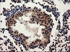 ADSL Antibody in Immunohistochemistry (Paraffin) (IHC (P))