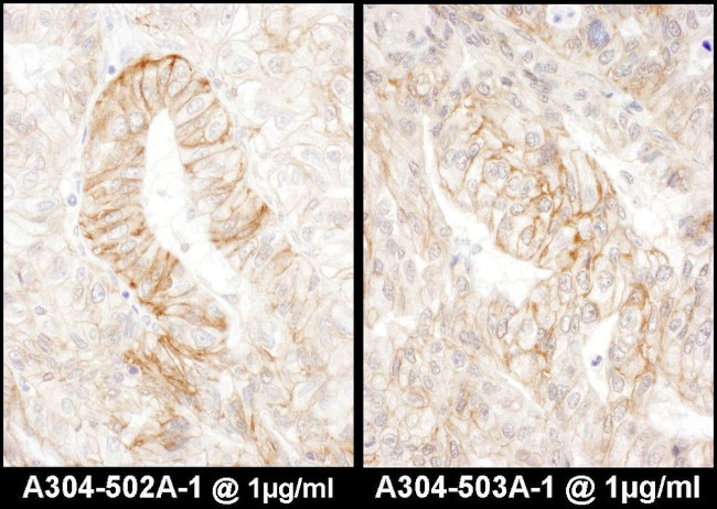 AE2 Antibody in Immunohistochemistry (IHC)