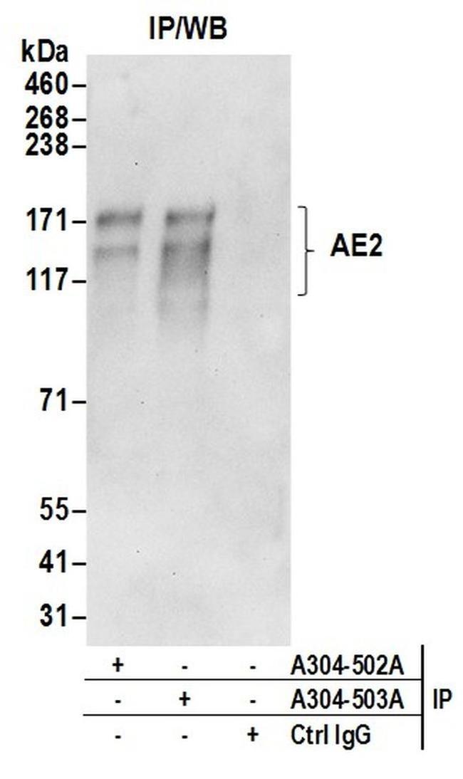 AE2 Antibody in Western Blot (WB)