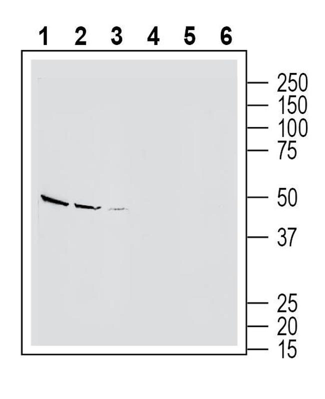 Endothelin Receptor B (extracellular) Antibody in Western Blot (WB)