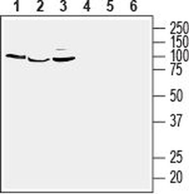 GPER1/GPR30 (extracellular) Antibody in Western Blot (WB)