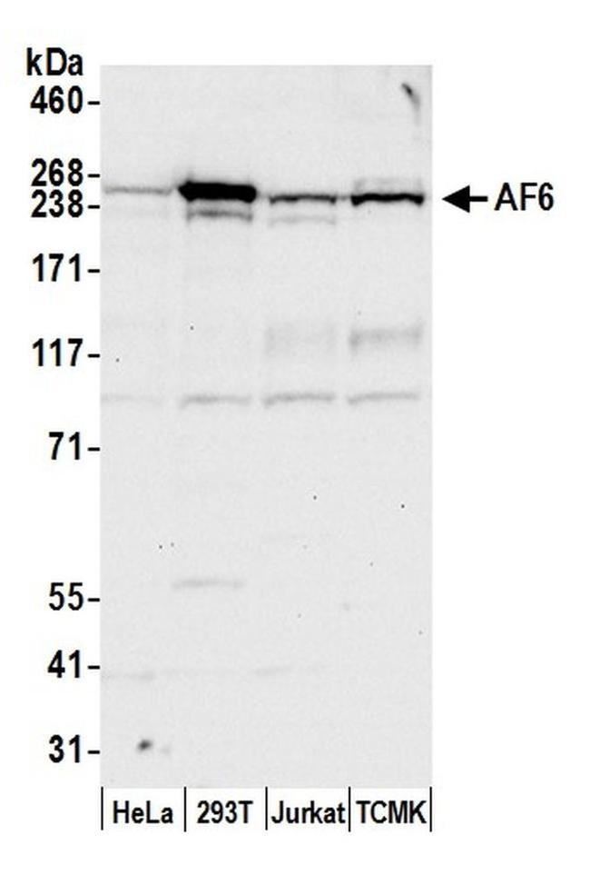 AF6 Antibody in Western Blot (WB)