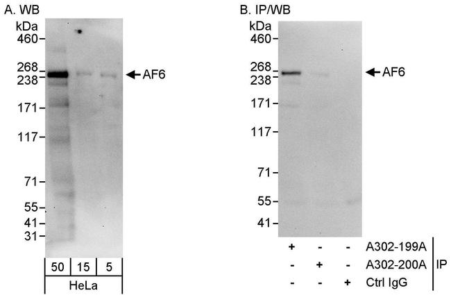 AF6 Antibody in Western Blot (WB)