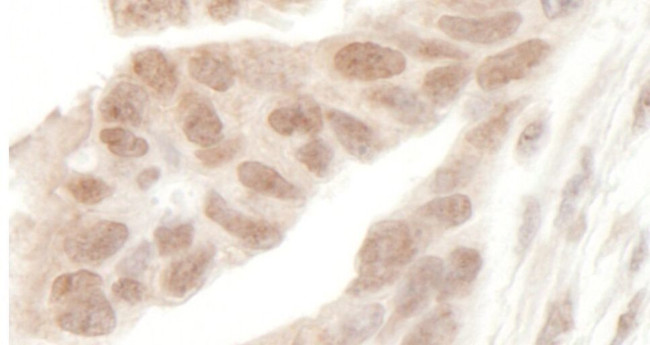 AF9 Antibody in Immunohistochemistry (IHC)