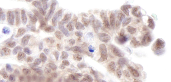 AF9 Antibody in Immunohistochemistry (IHC)