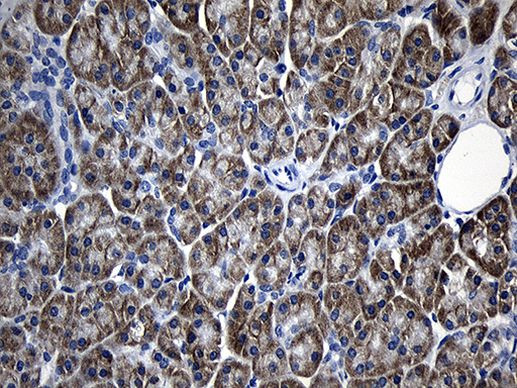 AFAP1 Antibody in Immunohistochemistry (Paraffin) (IHC (P))