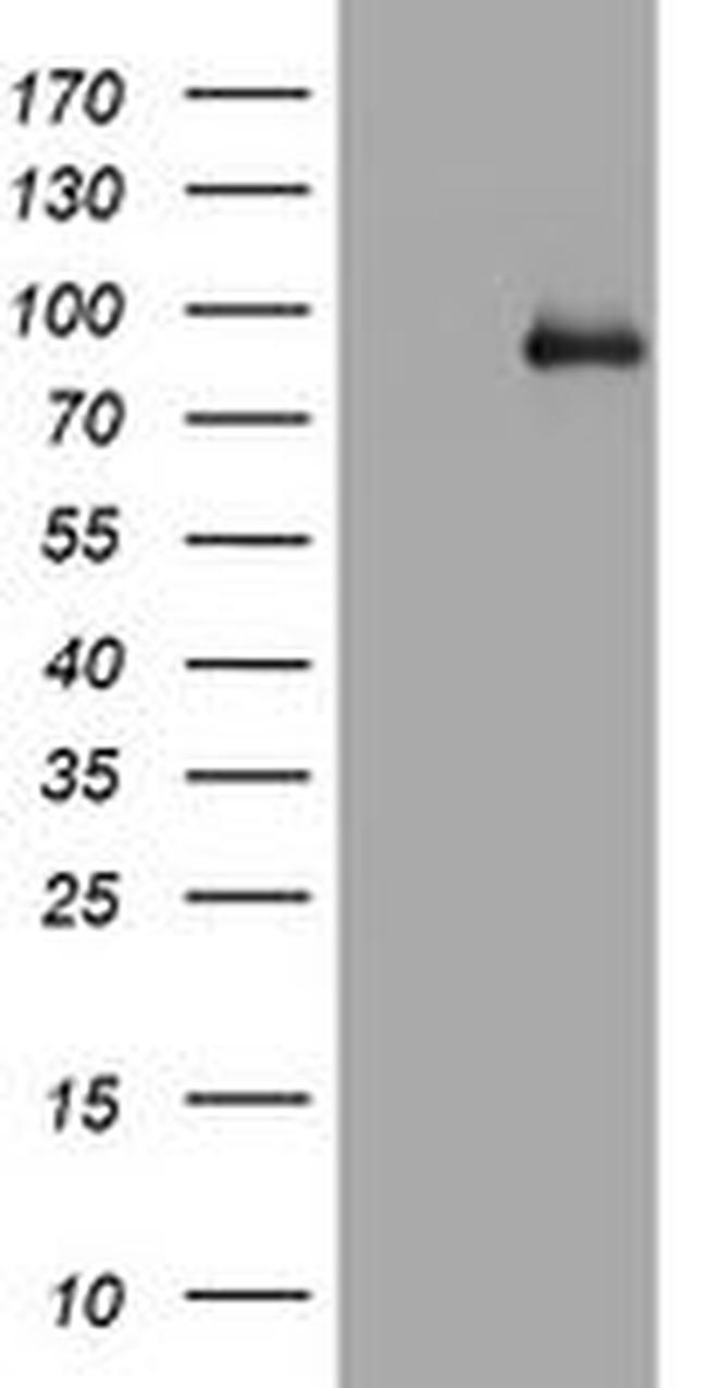 AFAP1 Antibody in Western Blot (WB)